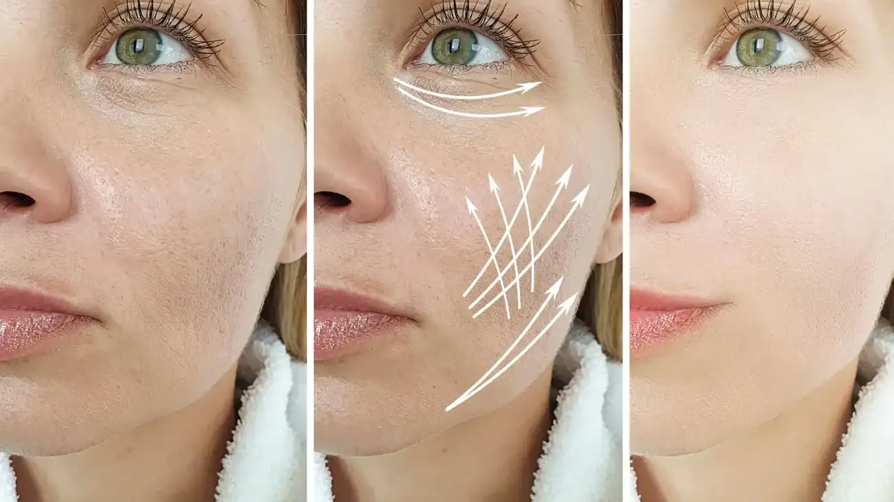Can One Treatment Really Tackle More Than One Skin Concern Staffordshire ?