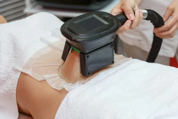 Image of person having fat freezing treatment to help weight gain Staffordshire
