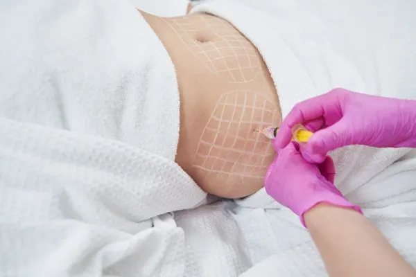 image of fat dissolving injections on love handles to help combat weight gain Staffordshire