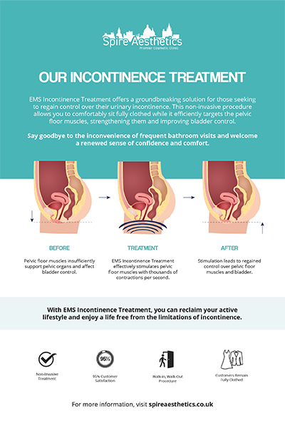 image to show how EMS treatment works for female urinary incontinence Staffordshire