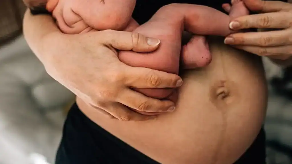 Why Is My Stomach Still Big After Pregnancy Staffordshire ?